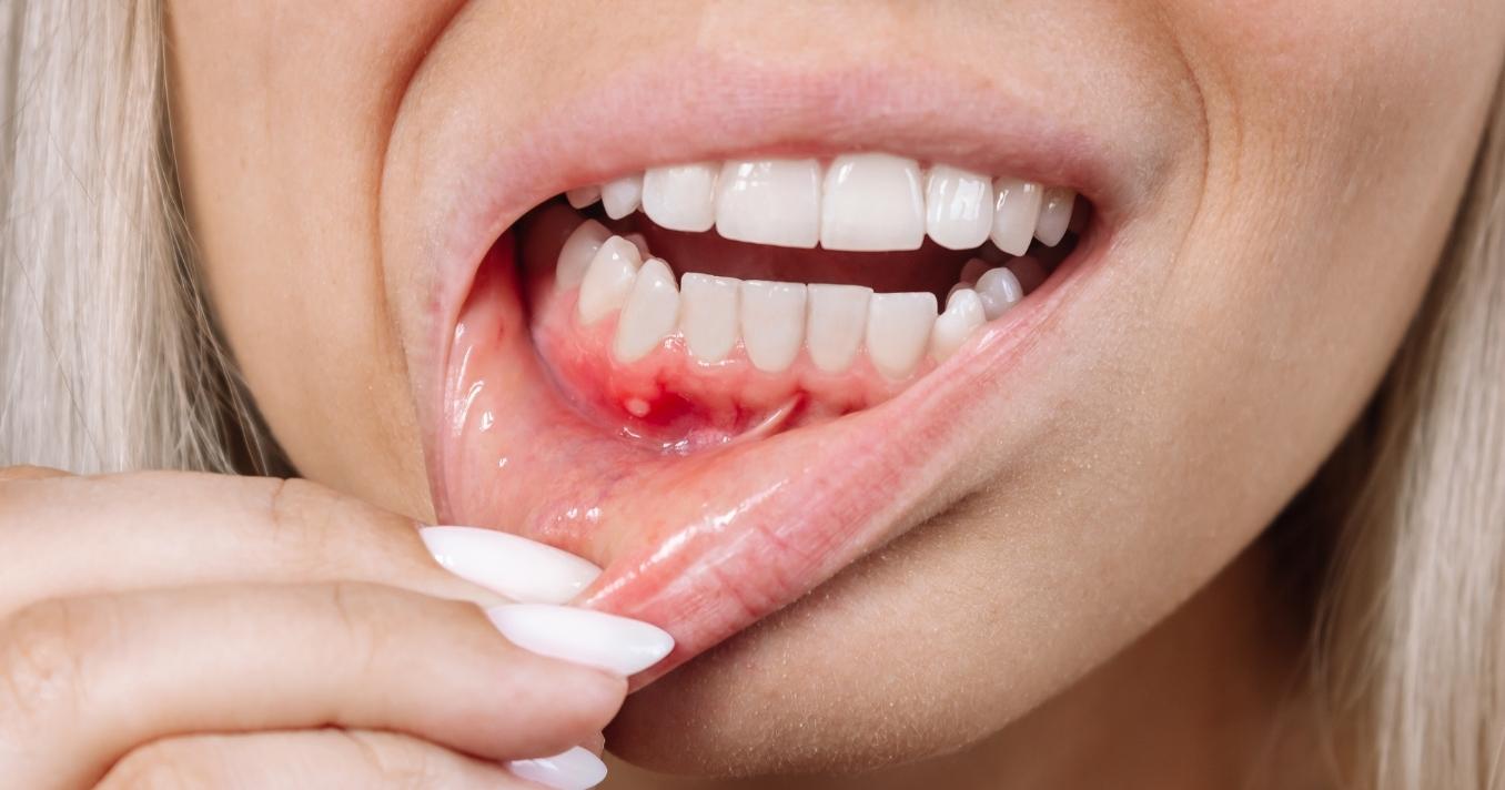 link between periodontal maintenance and diabetes
