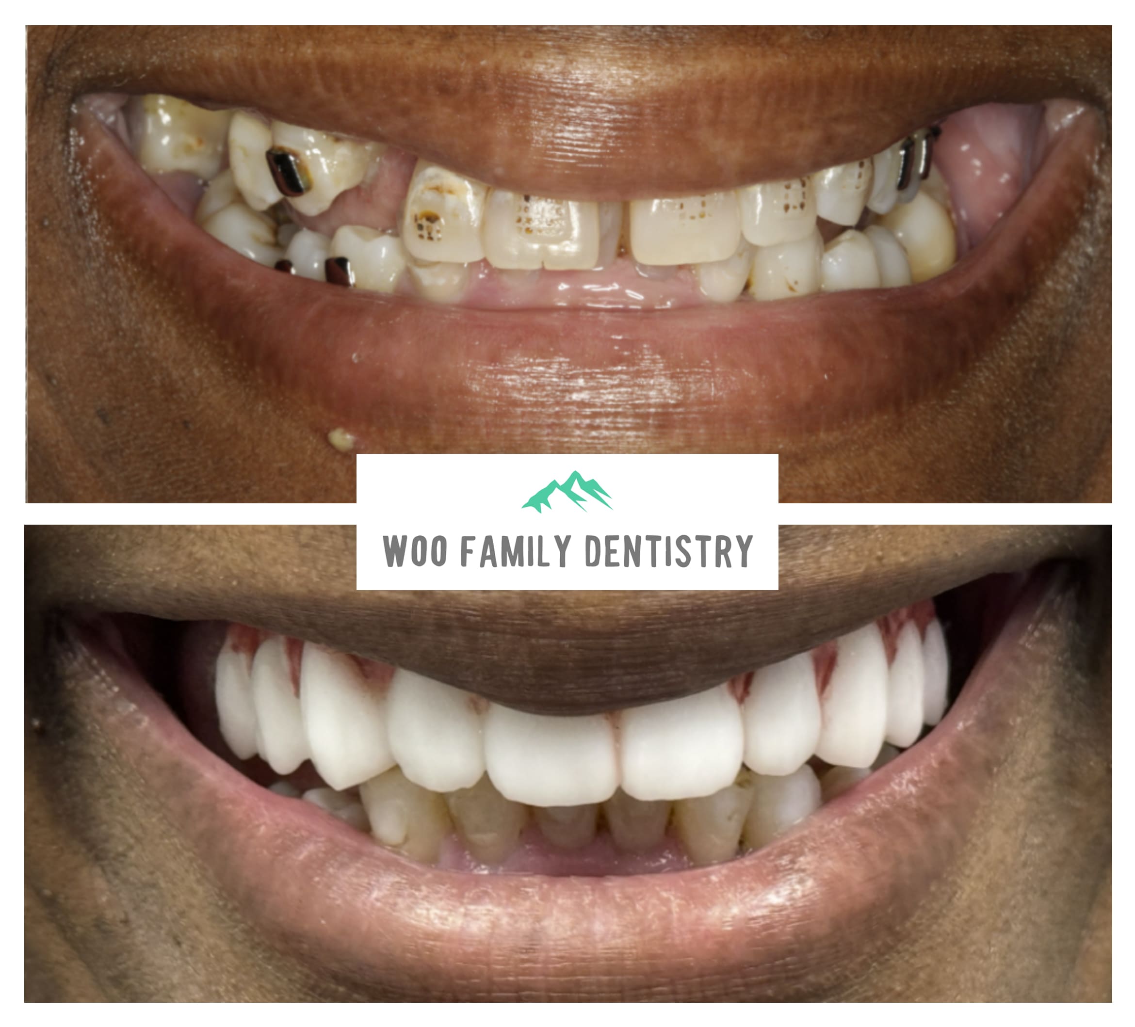 before-after-image